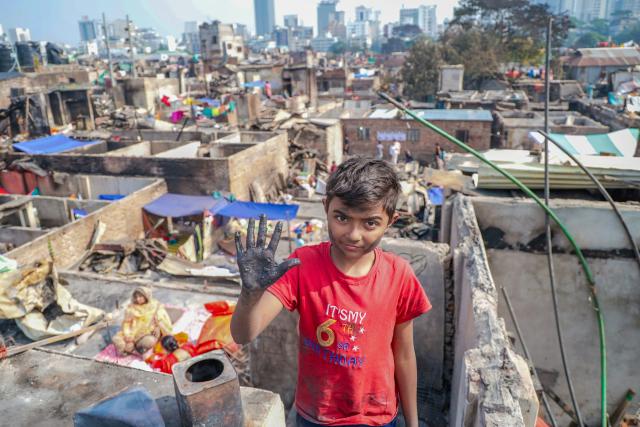 Open Sewers & Disease: Why Cholera Never Left Lahore's Slums